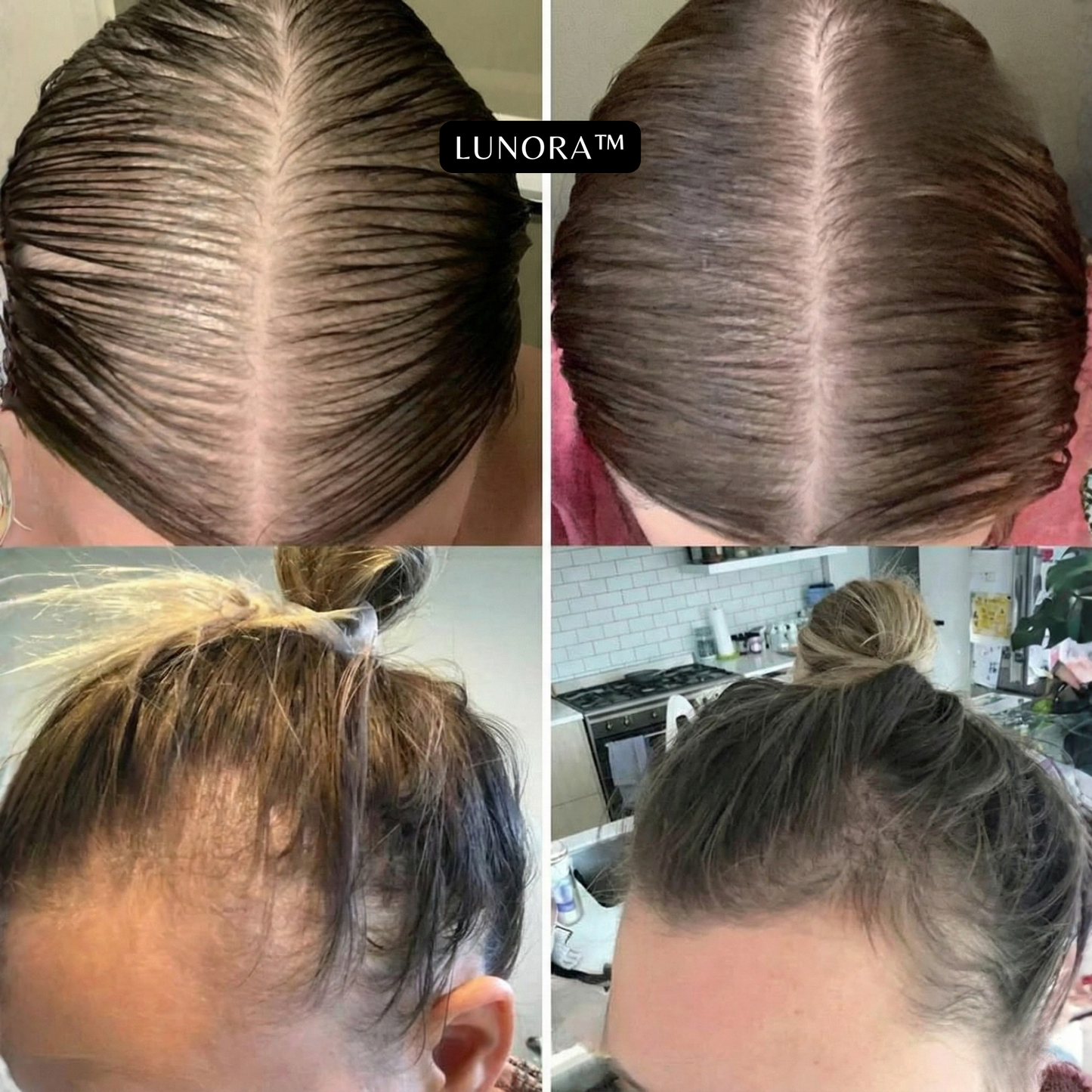 LUNORA™ Veganic Haar Groei Olie