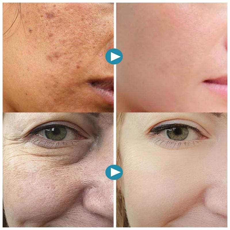 SilkPores™ – Sima, ragyogó bőr Dél-Korea ihlette