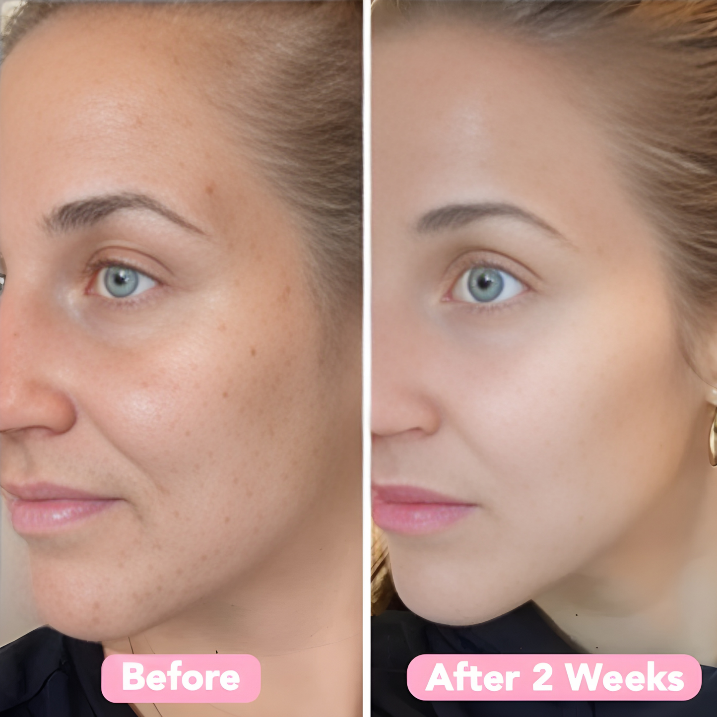 GlowClear™ - 40 Kojiczuur + Kurkuma Huidreinigingspads