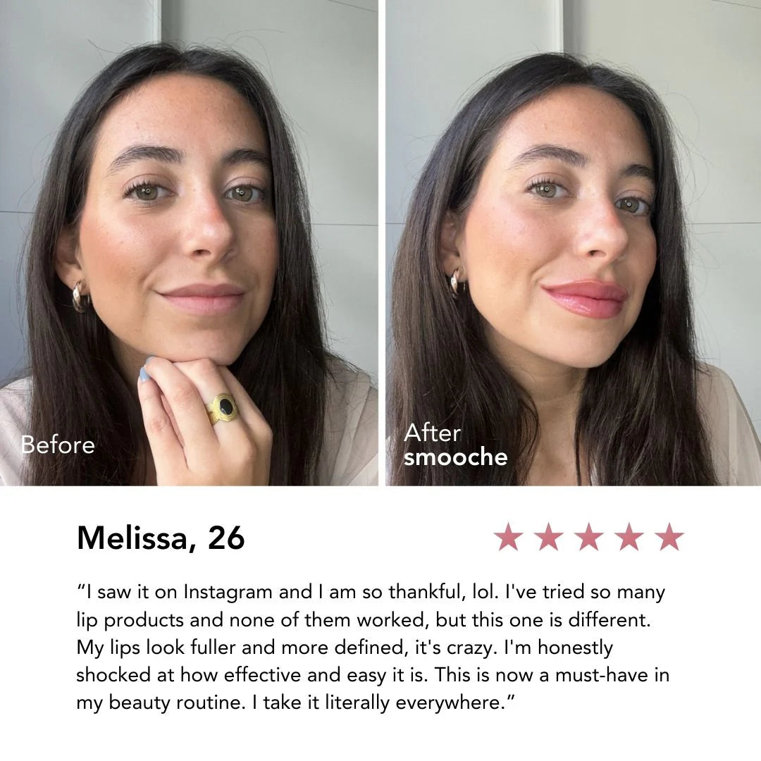 Smooche Lippenvergrößerer – Vollere Lippen in 10 Minuten