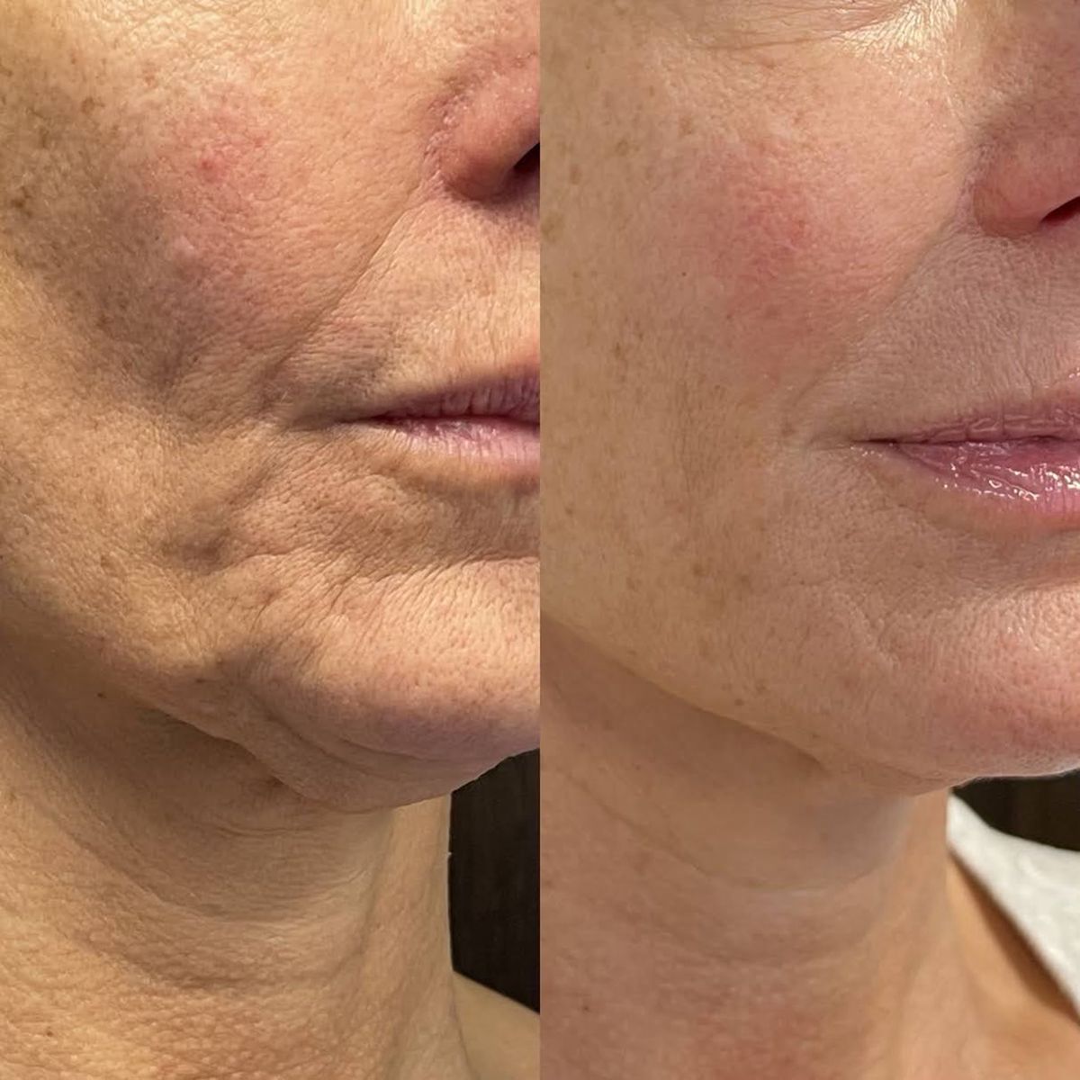 סטיק סרום נגד הזדקנות Nectaré