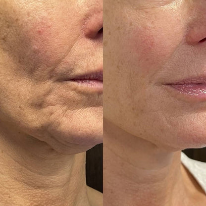 סטיק סרום נגד הזדקנות Nectaré