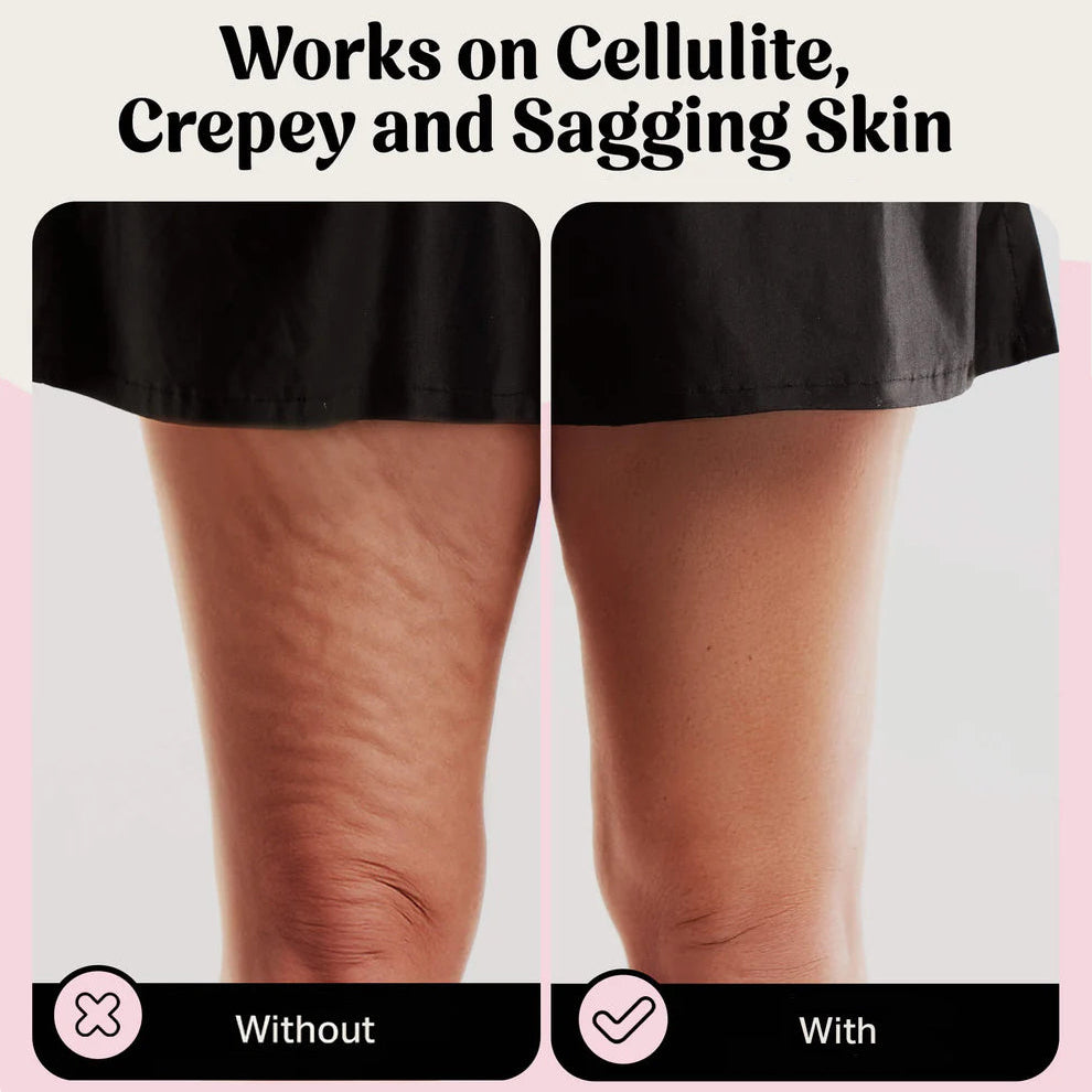 Élevare™ טייפ לעור