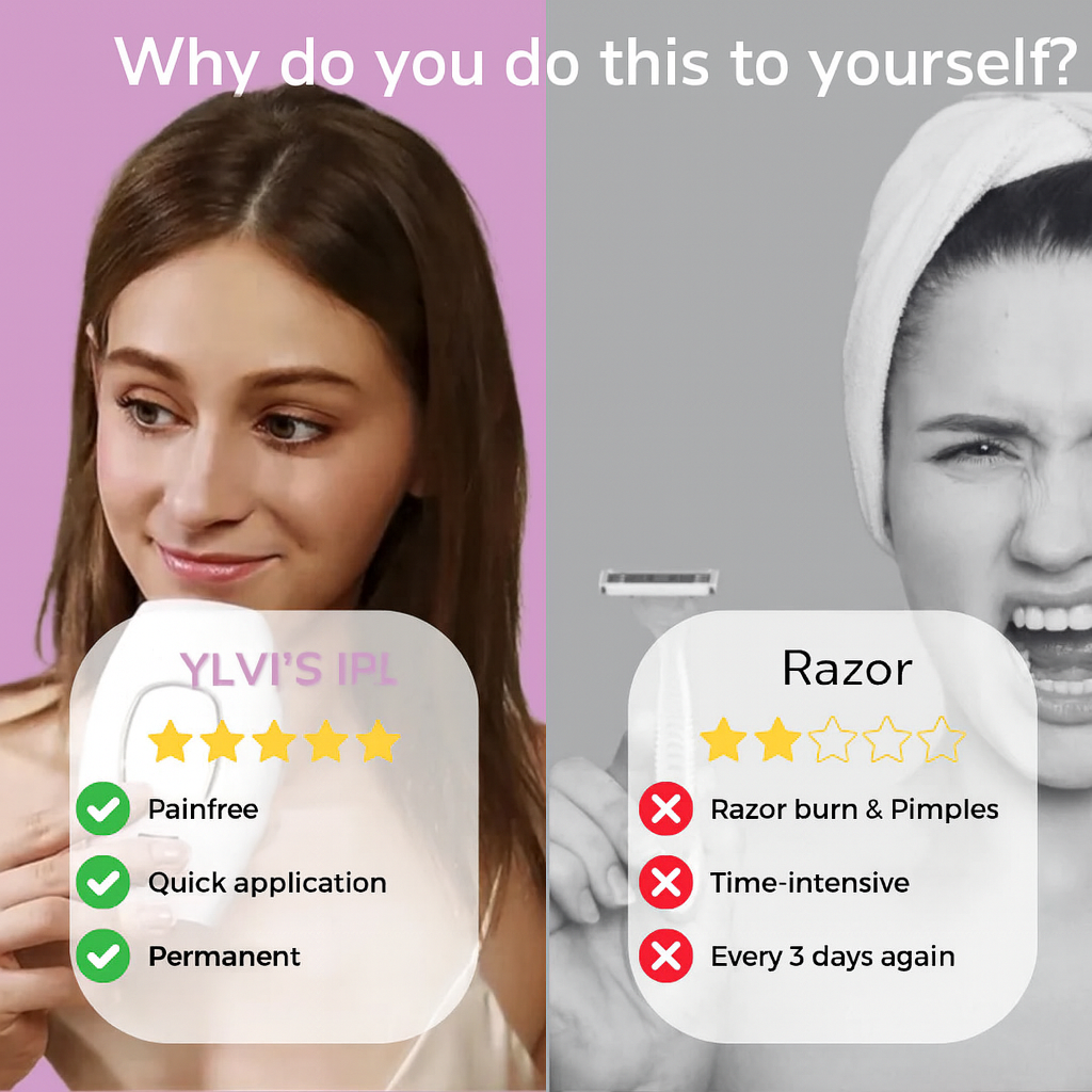 Ylvis IPL Depilator – Gładka, Bezwłosowa Skóra w Domu