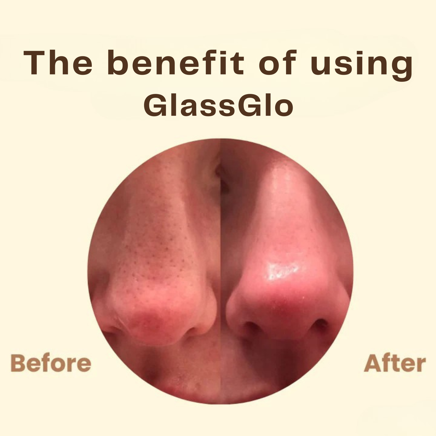 GlassGlo™ – Hĺbková čistiaca zlupovacia maska