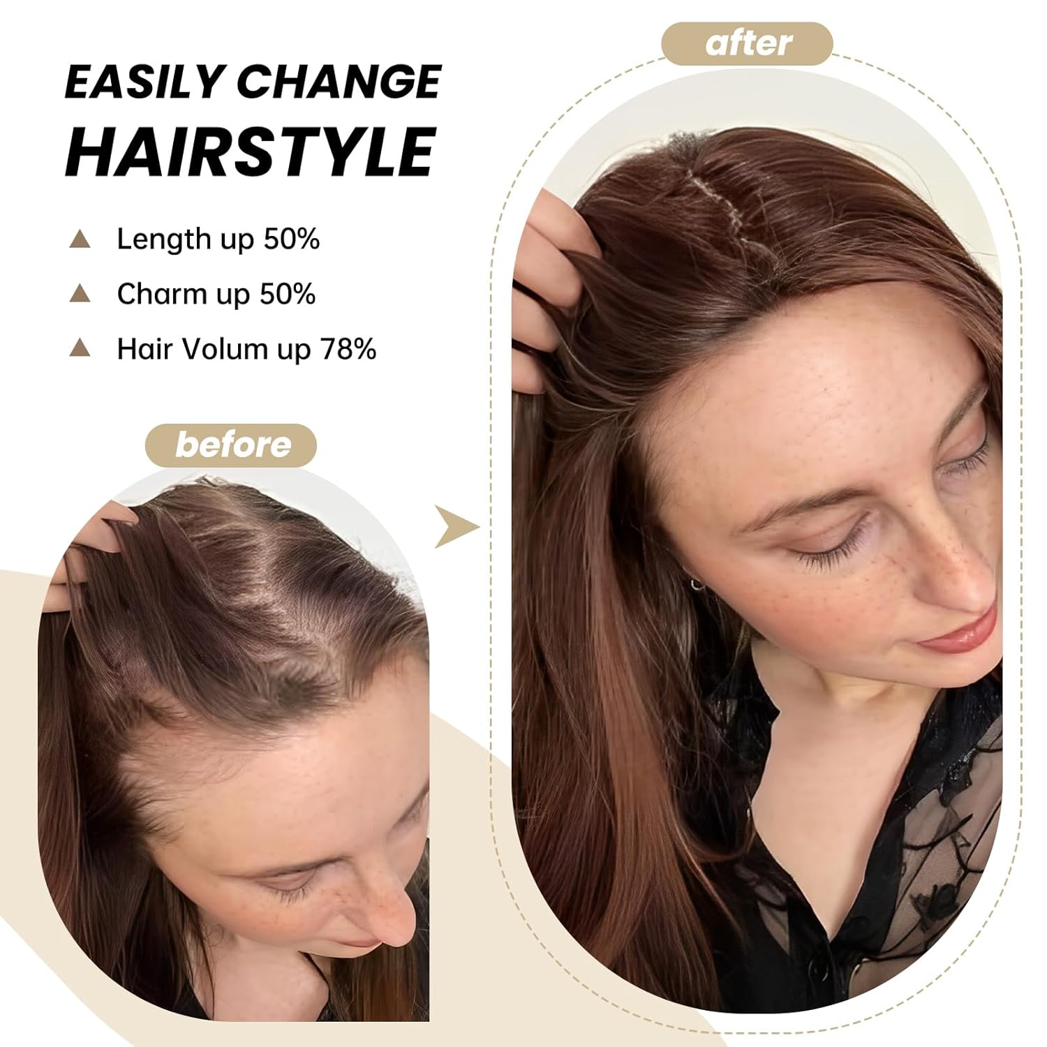 CrownEase™ – Wear Your Confidence Like a Crown