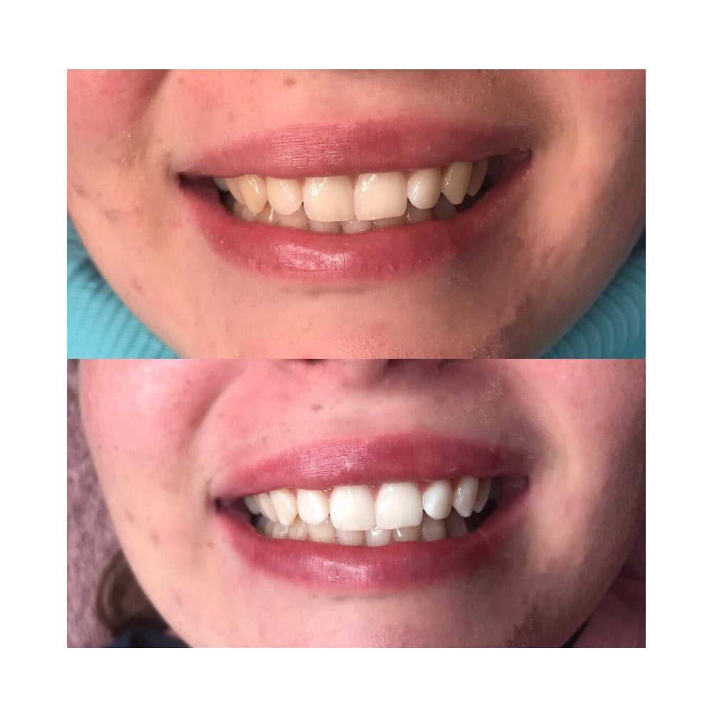 Valcero Lumière Pro -valkaisusarja