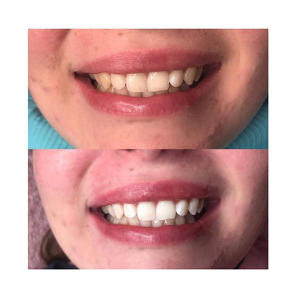 Valcero Lumière Pro -valkaisusarja