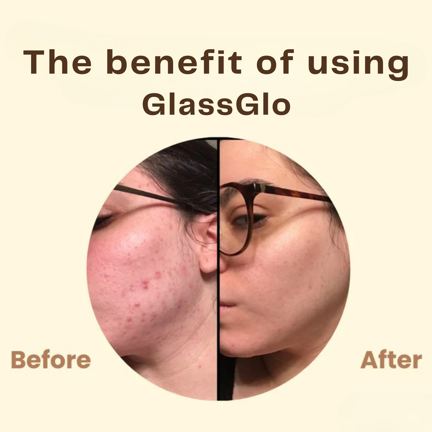 GlassGlo™ – Hĺbková čistiaca zlupovacia maska