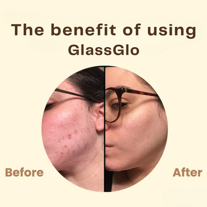 GlassGlo™ – Hĺbková čistiaca zlupovacia maska