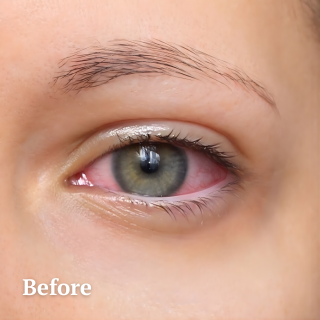 Aqua Relief Mist™ – Erfrischen Sie Ihre Augen sofort mit einem beruhigenden Nebel