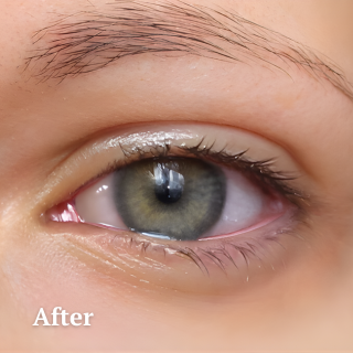 Aqua Relief Mist™ – Erfrischen Sie Ihre Augen sofort mit einem beruhigenden Nebel