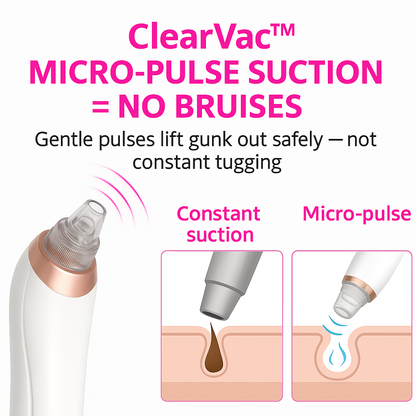 Pore Vacuum Pro™ – Okamžite odhaľte svoju hladkú, žiarivú pleť